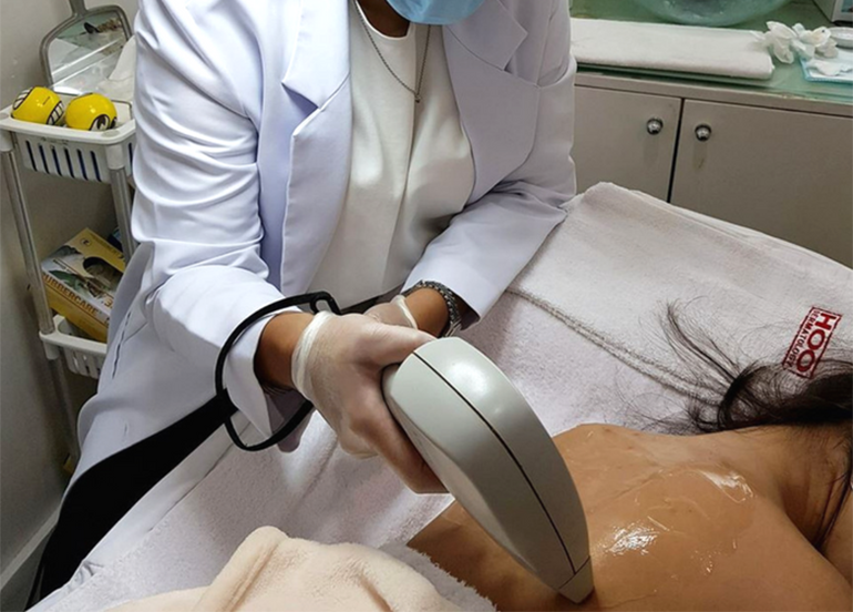 laser-procedure