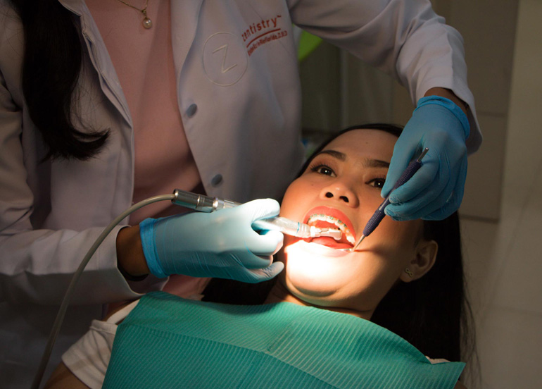 Oral Prophylaxis treatment done on patient from Dentistria