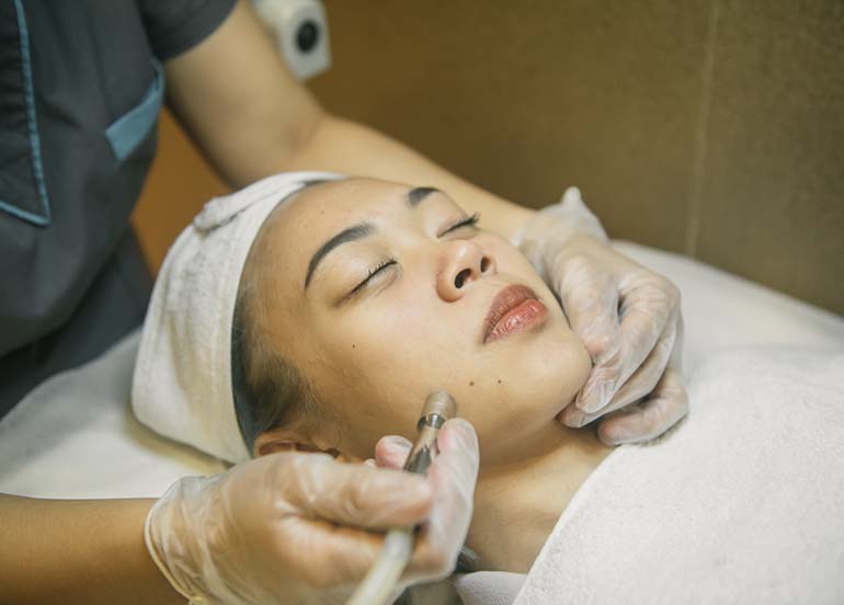 diamond-peel