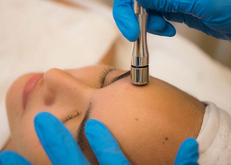 whitening-facial-with-diamond-peel